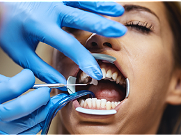 拔牙后的注意事项和饮食禁忌