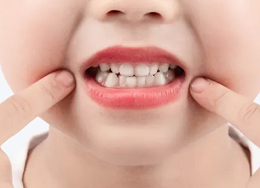 涂氟后多久能刷牙？河北惟德口腔医生专业答疑