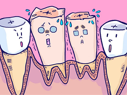 人工种植牙系列——即刻种植术讲解