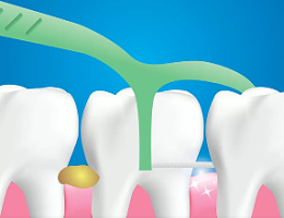 口腔问题可能要“命”！5大预警信号，别忽视